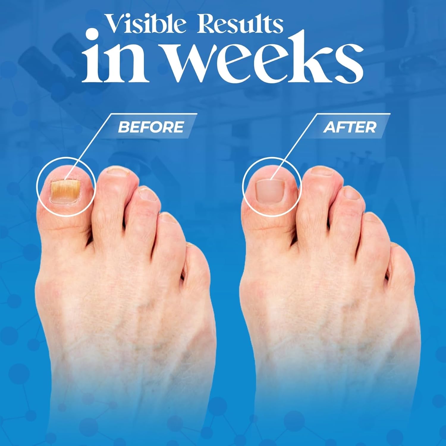 Aromasong Tea Tree Foot Soak with Eucalyptus